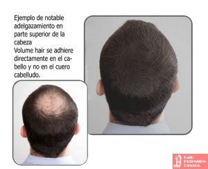 Fibra capilar