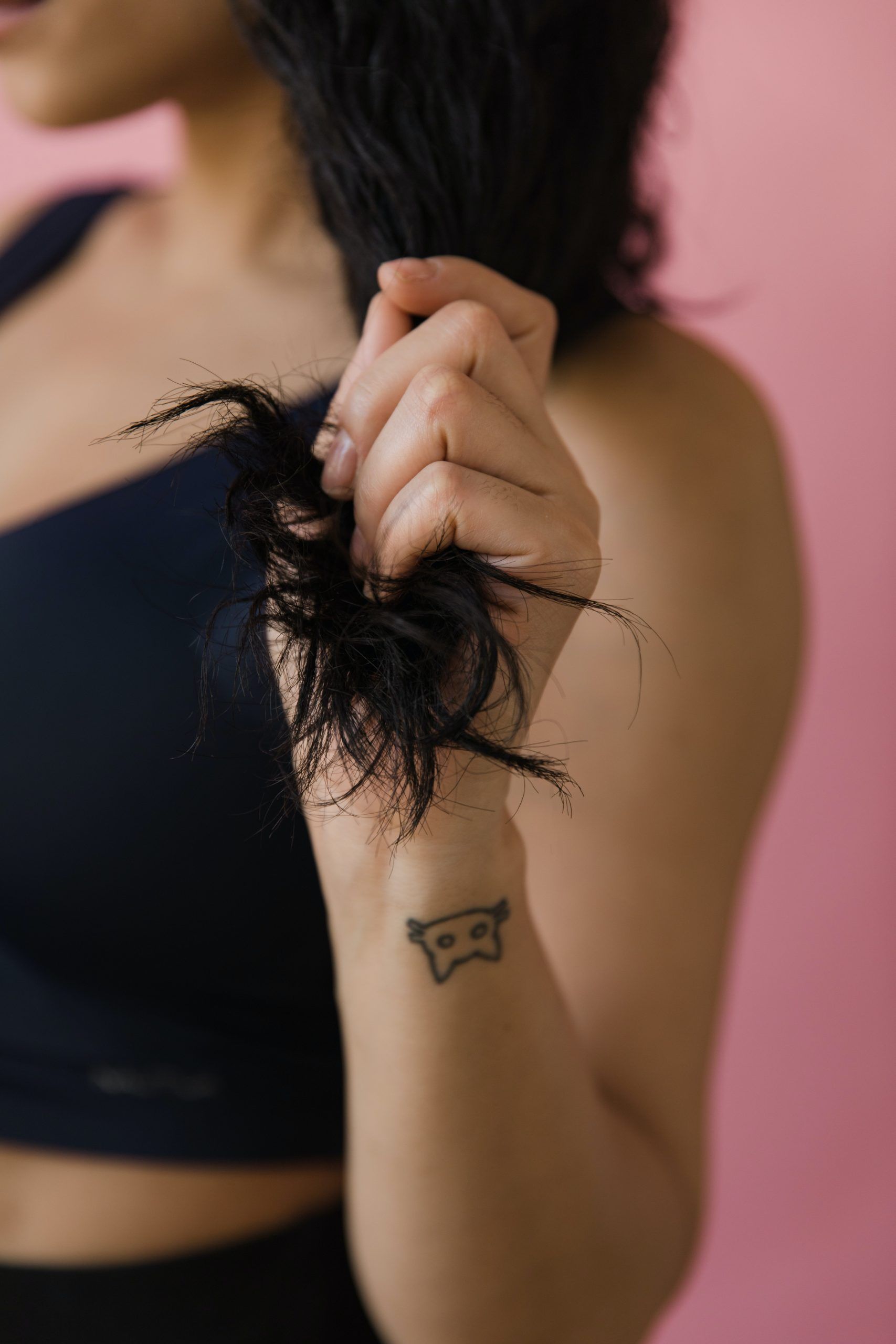 ¿Qué es la alopecia femenina y cuáles son sus causas y tipos?